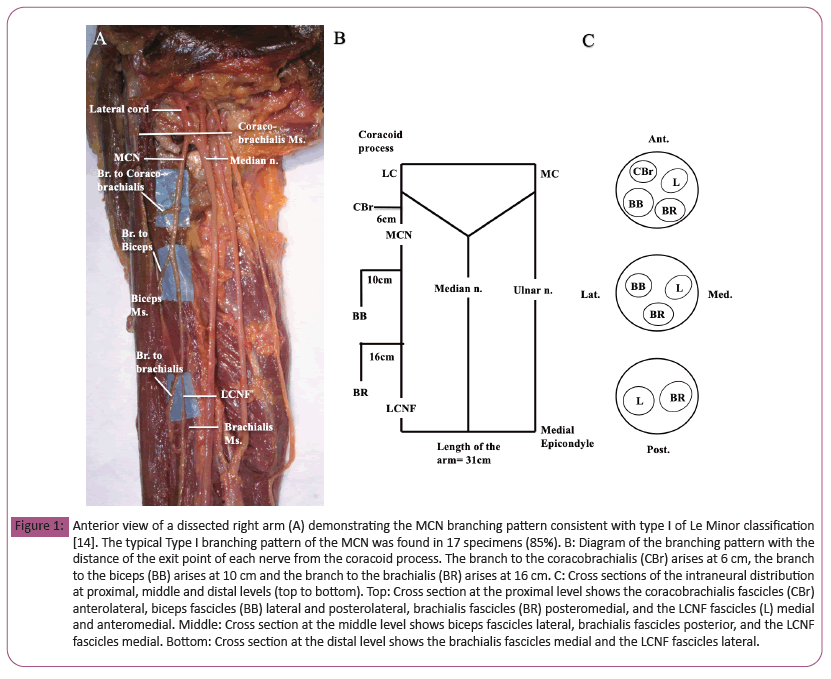 anatomical-dissected right arm